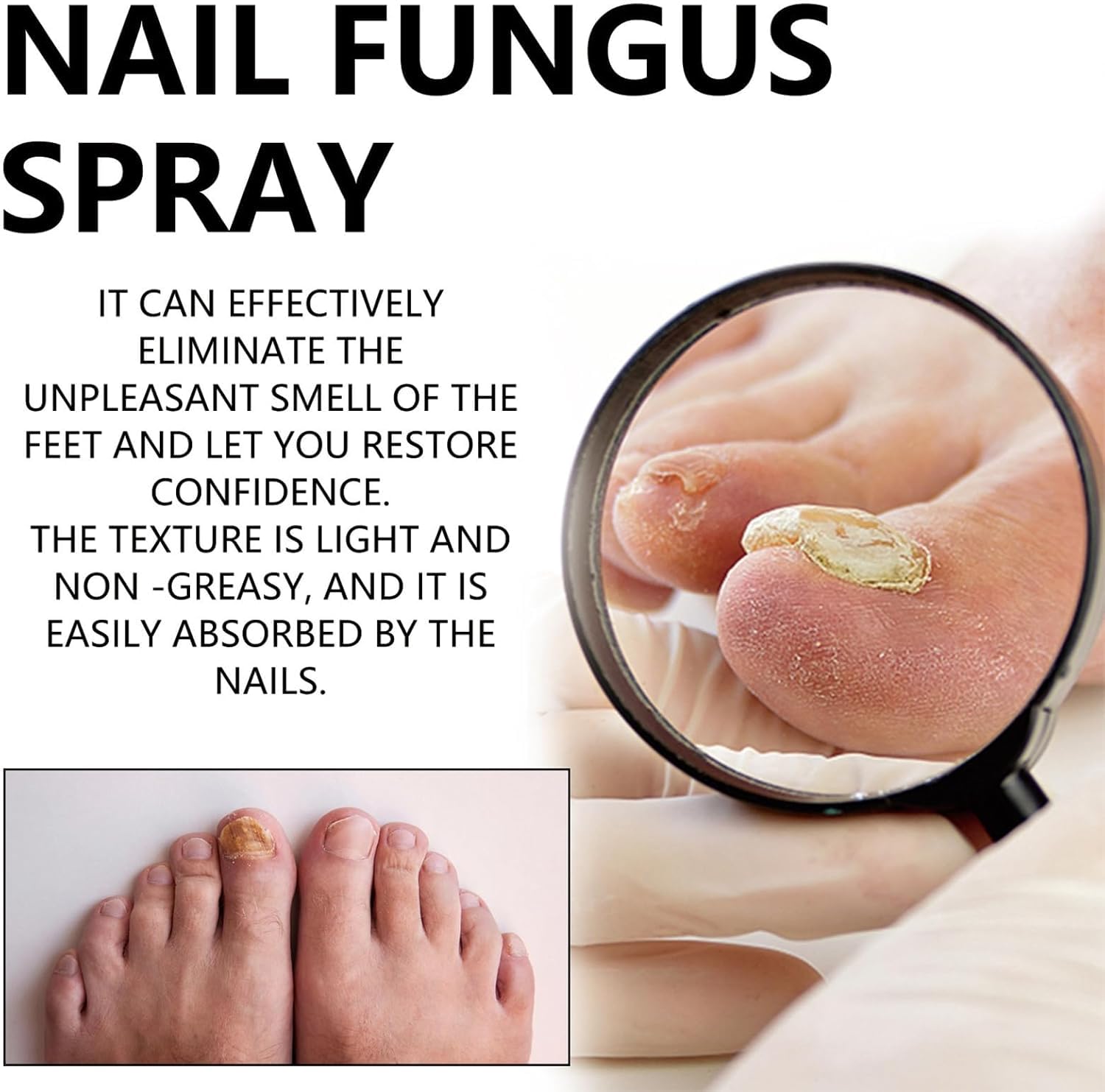 Nail Fungus Spray | Advanced Toenail Fungus Treatment & Nail Strengthener | Restore Healthy Nails with 100ml Antifungal Foot & Nail Spray