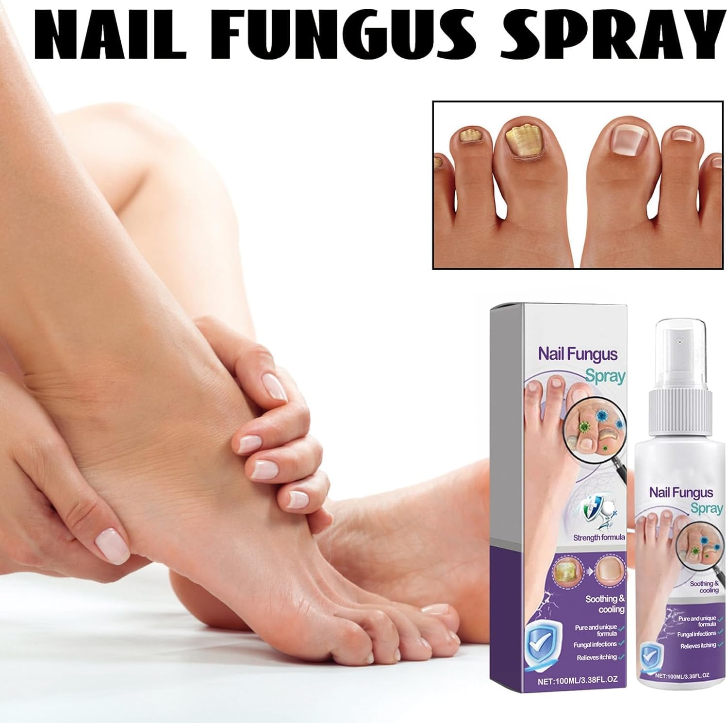 Nail Fungus Spray | Advanced Toenail Fungus Treatment & Nail Strengthener | Restore Healthy Nails with 100ml Antifungal Foot & Nail Spray