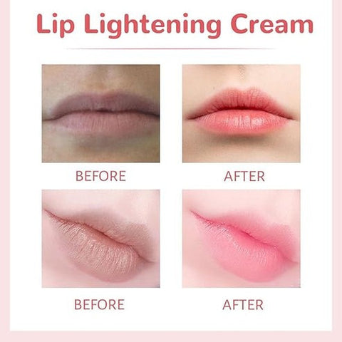 Lips Bleaching Cream Balm |  Brighten & Nourish Your Lips